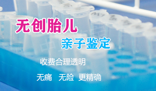 宁波怀孕了需要怎么办理DNA亲子鉴定,